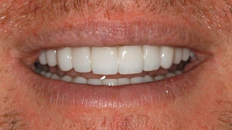 Konig Center for Cosmetic & Comprehensive Dentistry smile photos